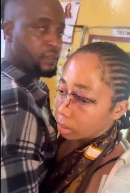 Outrage as Physically Assaulted Teen Wife Begs Authorities Not to Arrest Husband